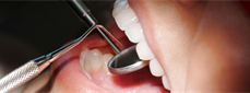A Survey of Continuing Education Needs of Military General Dentists