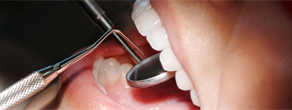 A Survey of Continuing Education Needs of Military General Dentists