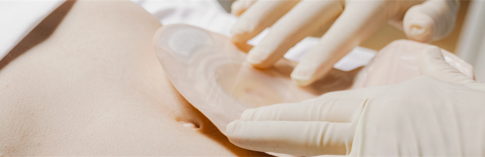 A Practice-embedded, PDSA-guided Implementation Study of Continuing Professional Development for Stoma Care in a Resource-constrained Setting