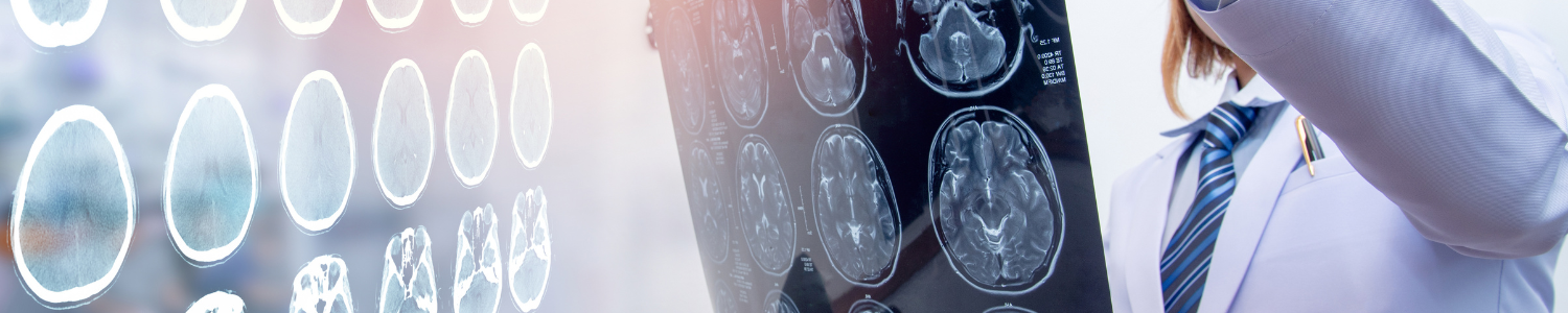 Caring for People with Severe Brain Injuries: Improving Healthcare
